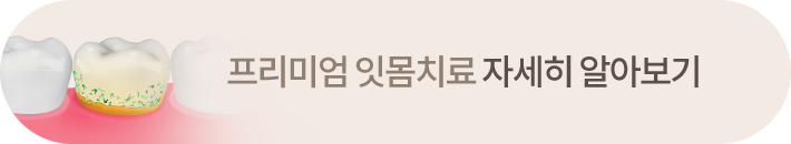 프리미엄 잇몸치료 자세히 알아보기